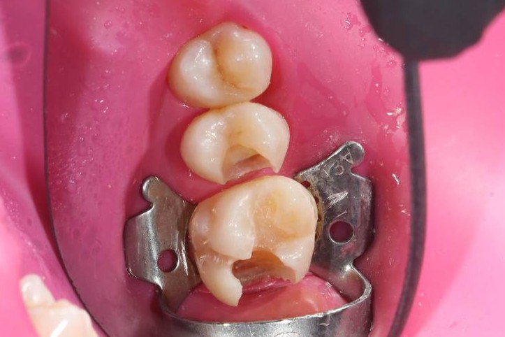 estetic-stomatology-2