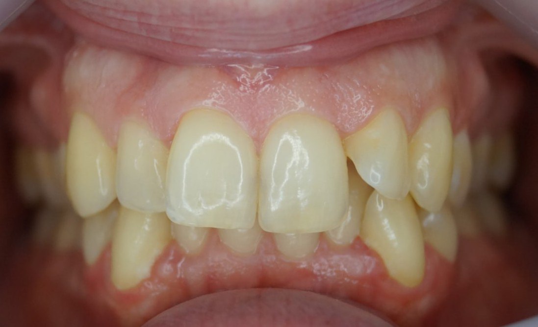 ortodontics-1